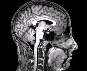 fMRI scan of brain